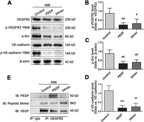 Figure 6. The 34mer peptide inhibited the phosphorylation of downstream proteins in a similar fashion to PEDF. (A) Representative Western blot image of phosphorylation of downstream proteins following PEDF or 34mer infection and overexpression during AMI. Densitometry analysis of (B) p-VEGFR2/VEGFR2, (C) p-Src/β-actin and (D) p-VE-cadherin Y685/VE-cadherin following infection with PEDF or 34mer peptide during AMI. (E) Heart tissue lysate was Co-IPed with anti-VEGFR2 antibody or rabbit IgG, and then analyzed by Western blotting with anti-PEDF, anti-34mer peptide and anti-VEGF antibody. #p < 0.05, ##p < 0.01 vs the control group, n = 3.