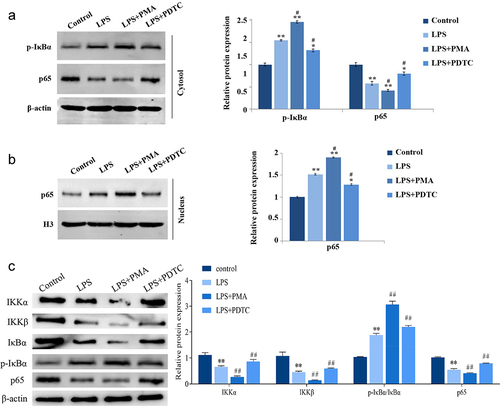 Figure 5. Expression of NF-κB signaling pathway-related proteins in hPDLSCs after LPS induction. Proteins expression of p-IκBα and p65 in the cytoplasm (a), p65 in the nucleus (b), and IKKα, IKKβ, p-IκBα, IκBα and p65 in human periodontal ligament stem cells (c) were detected with Western blot. hPDLSCs, human periodontal ligament stem cells; LPS, Lipopolysaccharide; PMA, NF-κB pathway agonist. PDTC, NF-κB pathway inhibitor. *P < 0.05 and **P < 0.01 vs. control group, #P < 0.05 vs. LPS group.