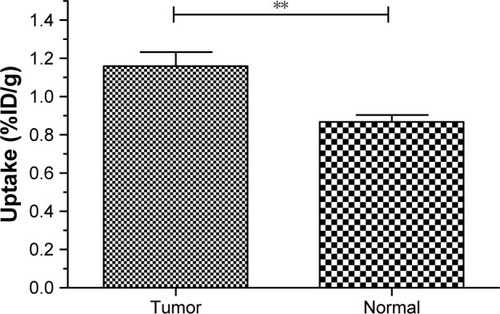 Figure 10 Comparison between the tracer uptake of ortho-[18F]F-1 in the tumor lesion of CCA rats (n=5) and normal liver region of the rats including CCA rats (n=13), P=0.0021, one-tailed Student’s t-test. **The statistical variation is p<0.005.