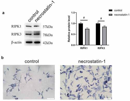 Figure 4. Necrostatin-1 inhibited the expression of RIPK1 and RIPK3. A, Protein expression levels of RIPK1 and RIPK3 by WB. B, Number of Nissl bodies by Nissl staining. #, p < 0.05