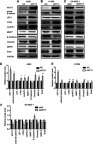 Figure 3 Expression of Wnt signaling pathway- and EMT-related proteins in non-small cell lung cancer cells after KRT17 overexpression or knockdown. (A, B, and C) Western blot analysis for proteins relevant to the Wnt signaling pathway and EMT in A549-KRT17 (A), H1299-KRT17 (B), SE-MES-1-siKRT17 (C), and their control cells. GAPDH served as an internal control. (D, E, and F) Relative expression levels of proteins for each group are shown in the histogram. *P<0.05; **P<0.01.Abbreviations: EMT, epithelial mesenchymal transition; NC, negative control cell; siNC, small interfering RNA negative control cell; siKRT17, small interfering RNA against keratin 17.