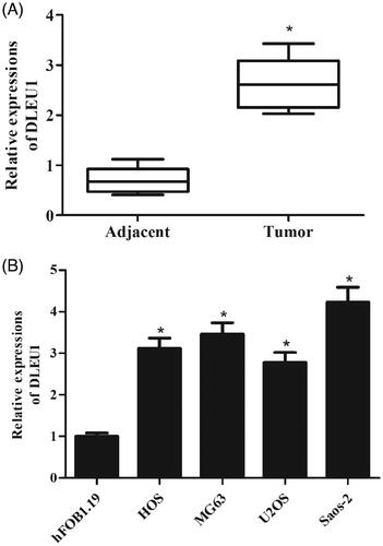 Figure 2. Expression levels of DLEU1 in specimens and cells. The expression levels of DLEU1 were examined using qRT-PCR analysis. (A) Expression levels of DLEU1 in 50 paired osteosarcoma tissues and adjacent non-tumour tissues. (B) Expression levels of DLEU1 in hFOB1.19 cells and osteosarcoma cell lines (HOS, MG63, U2OS, and Saos-2 cells). *p < .05.