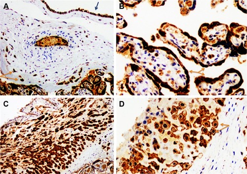 Figure 3 VEGF-R1. Representative immunohistochemistry staining for VEGF-R1 in the placental disc.