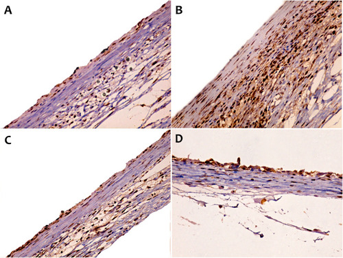 Figure 4 IHC estimation of PCNA expression in rats after two weeks of subcutaneous implantation.