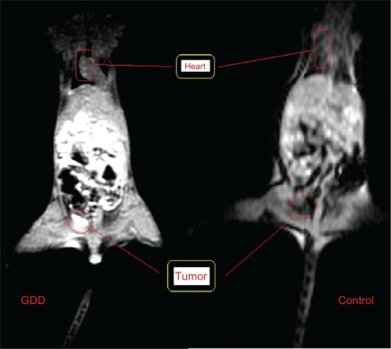 Figure 9B Illustration of the whole body magnetic resonance images prior and 20 minutes post intravenous Gd3+-DTPA-DG injection in mice bearing human lung cancer cells.Abbreviation: Gd3+-DTPA-DG, gadopentetate dimeglumine-D-deoxy-glucosamine.