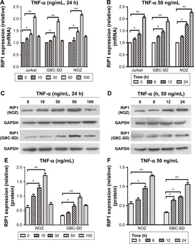 Figure 1 TNF-α enhances RIP1 mRNA and protein expression.