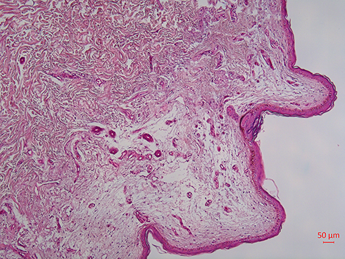 Figure 6 Histological features.