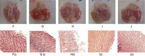 Figure 4.  Histological evaluation of antiulcer activity of CEBP against indomethacin-induced gastric lesions in rats (F) Stomach of an ulcer control rat; (G) Stomach of a rat pre-treated with omeprazole; (H) Stomach of a rat pre- treated with 100 mg/kg CEBP; (I) Stomach of a rat treated with 500 mg/kg CEBP; (J) Stomach of a rat treated with 1000 mg/kg CEBP. The respective histopathological section is shown below; (Fi) Stomach of the ulcer control animal showed normal on mucosa but with mild hemorrhagic and mild edema; (Gi) Stomach of omeprazole pre-treated animals showed normal mucosa; (Hi) Stomach of CEBP 100 mg/kg pre-treated animals showed mild hemorrhage and edema; (Ii) Stomach of CEBP 500 mg/kg pre-treated animals showed mild edema; (Ji): Stomach of CEBP 1000 mg/kg pre-treated animals showed mild effect on mucosa and mild hemorrhagic erosion but with moderate effect of edema