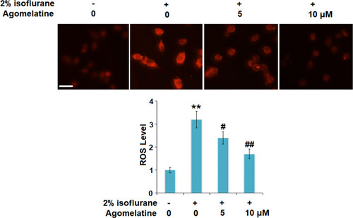 Figure 4 Agomelatine prevented isoflurane-induced oxidative stress in bEnd.3 brain endothelial cells. Cells were treated with 2% isoflurane in the presence or absence of agomelatine (5, 10 μM) for 24 h. Intracellular reactive oxygen species (ROS) was measured by dihydroethidium (DHE) staining. Scale bar, 100 μm (N=3, **, P<0.01 vs control group; #, ##, P<0.05, 0.01 vs isoflurane group).
