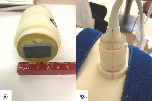 Figure 3. Ultrasound probe holder. (A) Highlight of the ultrasound imaging probe. (B) The embedded holder.