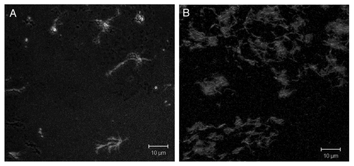 Figure 2. Fluorescence microscopy of the peptides at pH 5.0. (A) The peptide (aa 166-175 “B”). (B) The peptide (aa 166-175 “NB”). Staining was done with 7.5 μM ThT.