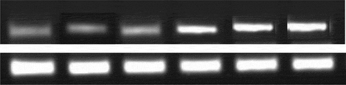 Figure 9. The electrophoresis results of each group of samples.