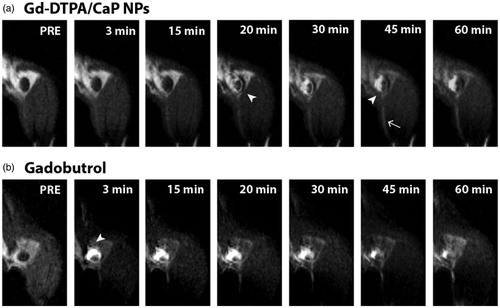 Figure 7. Gd-DTPA/CaP NPs accumulate in specific areas of the popliteal LN. MRI images showing the kinetics of Gd-DTPA/CaP NPs (a) or gadobutrol (b) uptake in the popliteal LN. Arrowheads point to regions of the LN with increased contrast enhancement. The arrow indicates a lymphatic vessel draining from the foot.