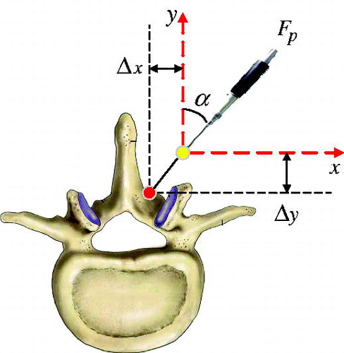 Figure 3. Diagram of the interaction between the vertebral body and surgical instrument.