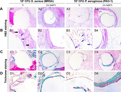 Figure 9 Histological analysis of Ti and 2% NSPTi implants in tibial bone tissues at 8 weeks after implantation; 103 CFU MRSA or PAO-1 in 100 µL sterile PBS (104 CFU/mL) was injected into the canal before implantation.Notes: H&E staining (A and B) suggested acute or chronic presence of inflammatory cells (blue arrows) with intramedullary abscesses and necrotic disintegrating bone fragments (black arrows) in the intramedullary tissue around uncoated Ti implants, while 2% NSPTi implants showed no apparent signs of bone infection. Consistent with the radiographic analysis, there was little bone formation around uncoated Ti implants, whereas significant bone formation (red arrows) was observed around 2% NSPTi implants, as shown by H&E staining (A and B) and Masson’s trichrome staining (C and D). A and B were to visualize and assess the new bone formation (A1–A4) and inflammation (B1–B4). C (C1–C4) and D (D1–D4) were used to evaluate new bone collagen. For A, magnification =50×. For B1 and B3, magnification =200×. For B2 and B4, magnification =100×. Column D is magnification of column C. For C, magnification =50×. For D, magnification =100×.bbreviations: MRSA, methicillin-resistant Staphylococcus aureus; NSPTi, nanosilver/poly (dl-lactic-co-glycolic acid)-coated titanium; PAO, Pseudomonas aeruginosa; S. aureus, Staphylococcus aureus; Ti, titanium.