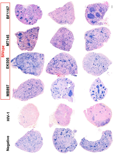 Fig. 2 CD4+ T cells in splenic tissues of SIVcpz- and HIV-1-infected hu-BLT mice at 16 wpi.CD4+ T cells in whole sections of splenic tissues were detected using immunohistochemical staining. CD4+ T cells are stained blue. Scale bar, 200 µm