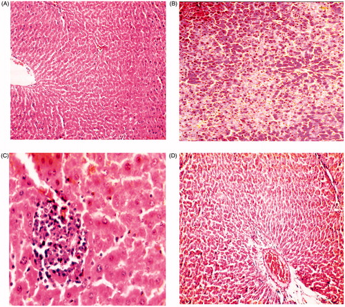 Figure 2. Photomicrograph of liver from (A) control rats showing normal histobasoligical structure (H&E × 300), (B) rats received CCl4 (100 mg/kg) showing severe fatty change in the hepatocytes (H&E × 300), (C) rats received CCl4 (100 mg/kg) and CO (100 mg/kg) showing degenerative changes in hepatocytes in the form of vaculation with focal mononuclear aggregation (H&E × 800), (D) rats received CCl4 100 mg/kg and CO (200 mg/kg) showing congestion of the central vein and hepatic sinusoids (H&E × 300).