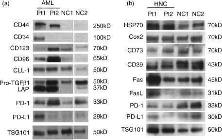 Fig. 5.  Western blot profiles of exosome proteins in fraction #4. Following mini-SEC, western blots were performed as described in Materials and Methods using concentrated aliquots of fractions #4 isolated from plasma specimens of (a) 2 patients with AML and 2 different NCs and (b) 2 patients with HNSCC and 2 different NCs. All lanes were loaded with 10 µg exosomal proteins. TSG101 was used as an exosome marker and a “loading control.” Immunoblotted proteins and their molecular weights are listed. AML=acute myeloid leukaemia; HNSCC=head and neck squamous cell carcinoma; NC=normal control; SEC=size exclusion chromatography.