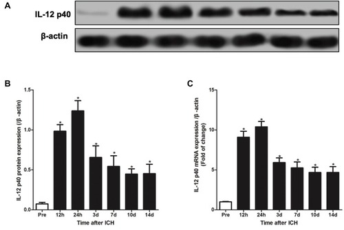 Figure 1 ICH induces IL-12 over-expression in rats. (A, B) Western blot analysis of IL-12 p35 protein expression in cerebral hemorrhage tissue at different times after ICH (A) and gray analysis of protein bands (B); (C) RT-qPCR was used to detect the expression of IL-12 p35 mRNA in cerebral hemorrhage tissue at different times after ICH. *P<0.05 versus (vs) pre (before ICH) group, and 5 rats per group.