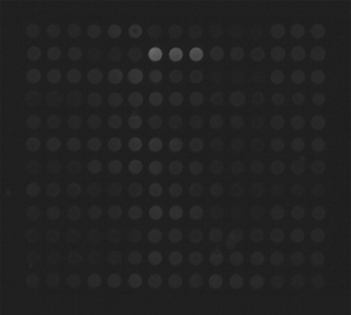 Figure 14. Microarray points from proposed scanner test result.