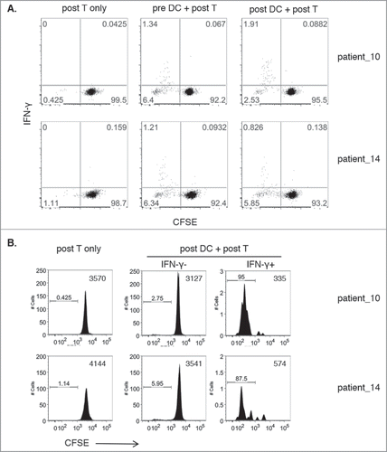 Figure 5. Proliferation of DRibble-responsive CD8+ T cells. 5A. Dot plots show IFN-γ release (y-axis) versus CFSE levels gated on CD8+ T cells of post-GVAX isolated T cells co-cultured with sorted pre-GVAX or post-GVAX UbiLT3 DRibble-stimulated DC for two patients. Post-GVAX T cells only were taken along as negative controls. 5B. Histogram plots show CFSE levels of T cells only and gated IFN-γ− CD8+ and IFN-γ+ CD8+ T cells from co-cultures of post-GVAX UbiLT3 DRibble-stimulated DC and post-GVAX T cells.