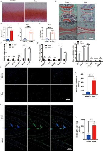 Figure 8 Experimental validation of TLR7. (A) Representative images of Safranin O–fast green–stained sections of articular cartilage from human with or without OA (n=6). (B) OARSI scoring system evaluation of human articular cartilage. (C) Representative images of Safranin O–fast green–stained sections of the keen joint from mice after sham operation or DMM surgery (n=5). (D and E) Severity of articular cartilage damage in mice after sham operation or DMM surgery, evaluated using the OARSI scoring system. MFC: medial femoral condyle; MTP: medial tibial plateau. (F and G) Changes of mRNA expression levels of CRISPLD2, IL1B, SLC25A37, MMP9, and TLR7 in human and mice samples (n=3). (H) After TNFα-induced, the mRNA expression levels of Tlr7, Mmp9, Il6, CRISPLD2, IL1B, and SLC25A37 were significantly higher in the ATDC5 cell line (n=3). (I and K) Immunofluorescence staining for TLR7 was conducted on articular cartilage samples obtained from both healthy individuals and OA patients, followed by quantitative fluorescence analysis (n=3). TLR7 stains green. Dapi stains the nucleus. (J and L) Immunofluorescence staining of Tlr7 was performed in articular cartilage from mice at sham or DMM-surgery, and quantitative fluorescence statistics were analyzed. Tlr7 stains green. Dapi stains the nucleus (n=3). p < 0.05= *, p < 0.01= **, p < 0.001= ***, p < 0.0001= ****, p >0.05 = ns.