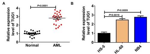 Figure 1 Upregulated expression level of TUG1 was observed in AML bone marrow or cells. (A) qRT-PCR analysis for TUG1 expression level in AML marrow samples and healthy controls. (AML: 2.821 ± 0.654 VS Normal: 1 ± 0.2599, P<0.0001) (B) TUG1 expression level in AML HL-60 and NB4, as well as normal marrow cells HS-5. (HL-60: 2.467 ± 0.251 VS HS-5: 1 ± 0.24, P=0.0019; NB4: 2.767 ± 0.252 VS HS-5: 1 ± 0.24, P=0.0009).