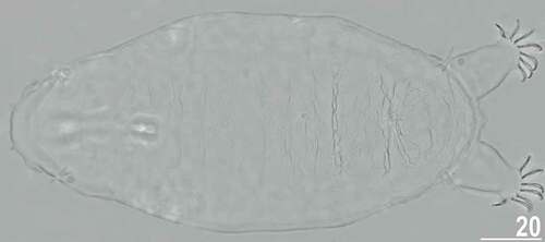 Figure 5. Habitus of the holotypic female of Echiniscoides bufocephalus sp. nov. (PCM). Scale bar in μm.