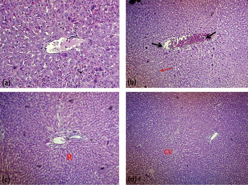 Figure 3. Histopathology of liver of experimental rats (a) Section from liver of normal rats showing normal histology of the liver with central vein [H & E × 400]; (b) Section from liver of diabetic rats showing central vein dilation with some congestion [black arrow] and lymphocytic infiltration [red arrow] [H & E × 400]; (c) Section from liver of glibenclamide treated rats showing normal histomorphology [H & E × 400]; (d) Section from liver of MEMP extract treated rats showing normal histomorphology [H & E × 400].CV: Central vein; R: Regeneration.