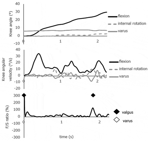 Figure 4d. Knee biomechanics during a slow, single-leg squat from 0° to 30° knee flexion in subject 4. Quantitative analysis of the F/S spikes detected only one valgus KW at 0-5° knee flexion, and one valgus KW at 20-25° knee flexion during the descending phase of the first squat. Notably, the second KW occurred with increasing knee varus angular velocity