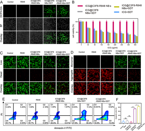 Figure 2 In vitro curative effect of the ICG@C3F8-R848 NBs upon SDT. (A) Fluorescence images analyses of intracellular ROS generation as indicated by DCFH-DA detection after receiving different treatments as indicated. (Scale bar = 50 μm). (B) Cytotoxicity analysis of differential treatments at different concentrations. (C) Representative fluorescence images of cells stained with calcein AM (green, live cells) and propidium iodide (red, dead cells) in different treatment (scale bar = 50 μm). (D) Fluorescence images of the JC-1 monomer (green channel), and aggregate (red channel) in the mitochondria of HCC cells after differential treatments as indicated. (scale bar = 50 μm). (E) The apoptotic frequency was analyzed by flow cytometry after different treatments. Total apoptosis rate was calculated by Q2 (early apoptosis) and Q3 (late apoptosis). (F) Quantification of the total apoptosis rates. Data are expressed as mean ± SD (n = 3). Statistical significances were calculated via one-way analysis of variance (ANOVA). *P < 0.05, ****P < 0.0001.
