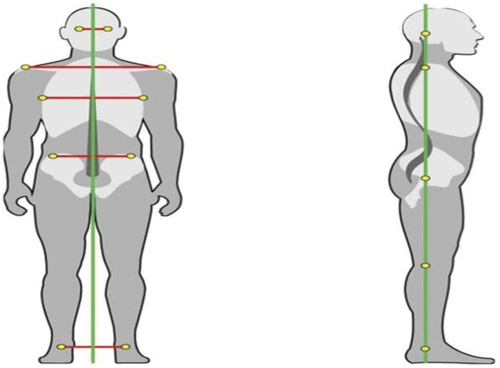 Figure 2. The reference points used for the frontal and lateral postural examination.