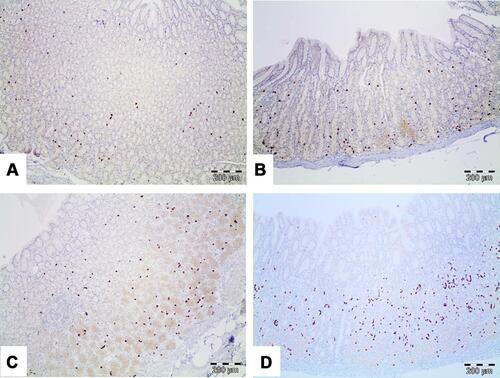 Figure 2 Immunohistochemical study for gastric cells with ghrelin positivity (A–D). Micrographs show different expression patterns of positive ghrelin cells within the gastric mucosa. (A) Irregular pattern. (B and C) Pattern of predominance in two thirds of the mucosa. (D) Pattern with a predominance in low third of the mucosa (direct increase 10X).