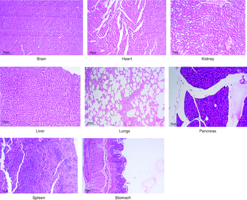 Figure 6. Represent the micrograph of the various vital organs from the group consuming 500 mg/kg of PHF tablet.