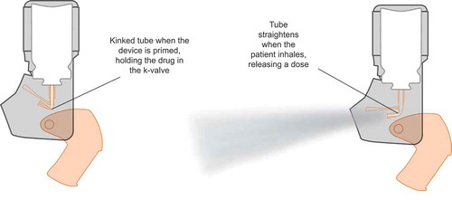 Figure 1. The functionality of the k-valve®.