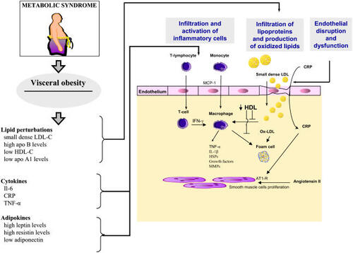 Figure 2 The metabolic syndrome is characterized by visceral obesity and its attendant metabolic perturbations that have numerous pro-atherosclerotic effects on the arterial wall. Production of small dense LDL particles and decrease HDL levels increase vascular infiltration by lipids and the production of oxidized LDL (ox-LDL). Ox-LDL delivers a danger signal to the macrophages and the production of foam cells producing cytokines and growth factors that will promote the development of atherosclerosis. In addition, elevated blood levels of cytokines and of adipokines contribute to increase the inflammatory reaction.