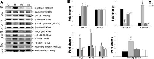 Figure 5 (A, B) Bands of Western blot for levels of test proteins after Ro25-6981 or iwp-2 administration in remifentanil-induced hyperalgesia. Values for relative density of the proteins among groups. Protein is expressed relative to β-actin (n = 3) or Histone H3 (n = 3). Groups allocation: R: Group remifentanil; C: Group Control; Ro: Group Ro25-6981 plus remifentanil; iwp: Group iwp-2 plus remifentanil. *P < 0.001 compared with Group C, #P < 0.001 compared with Group iwp, ΔP < 0.001 compared with Group Ro.