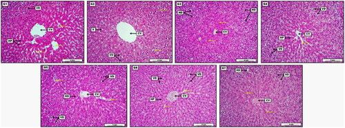 Figure 6. Photomicrograph of liver from groups; G1: Control negative group received (D.W); G2: Low dose group (G2) treated with 30 mg/kg of S-AgNPs-CSCFX; G3: Medium dose group (G3), treated with 60 mg/kg of S-AgNPs-CSCFX; G4: High dose group (G4) treated with 90 mg/kg of S-AgNPs-CSCFX; G5: Low dose group (G5) treated with 30 mg/kg of blank S-AgNPs; G6: Medium dose group (G6) treated with 60 mg/kg of blank S-AgNPs; G7: High dose group (G7) treated with 90 mg/kg of blank S-AgNPs. H&E. Scale bar: 4 mm.