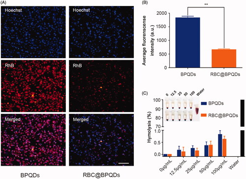 Figure 4. The biocompatibility of RBC@BPQDs-DOX/KIR. (A) CLSM micrographs of macrophages after cultured with BPQDs-RhB and RBC@BPQDs-RhB for 4 h. The scale bar: 20 μm. (B) Fluorescence intensities of collected cells after treatment with BPQDs-RhB and RBC@BPQDs-RhB, as quantified by a fluorometre. (C) Haemolysis rate of RBCs at various concentrations of BPQDs and RBC@BPQDs at 37 °C after 2 h. Data are mean ± SD (n = 3). **p<.01.