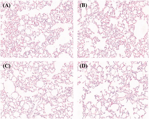 Figure 5. H&E staining of lung tissues i.v. administration of (A,C) CEQ-loaded microspheres or (B,D) microspheres only after (A,B) 12 h and (C,D) 48 h.