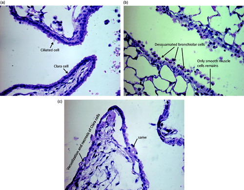Figure 4. Lung from mouse 24 h after exposure to air (a) or ZnO_2 (b and c). ZnO exposure lead to desquamation of bronchiolar cells as shown in panel b, and vacuolization and necrosis of Clara cells (c). The deposited dose of Zn_2 in the lower respiratory tract is 0.83 μg. The slide section is representative for effects seen in the group.