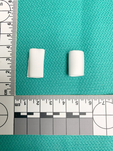 Figure 1. Presents a photo of the test and control conduits used in this study prior to implant. The graft on the left of the photo is the test conduit, with a diameter 10–11 mm at implant. The graft on the right is the control conduit, 10 mm in diameter at implant.