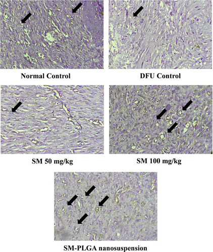 Figure 13 Effect of SM-PLGA nanosuspension on CD-31 expression. Images were captured at 400× optical zoom. Arrows indicate positive cells for CD-31.