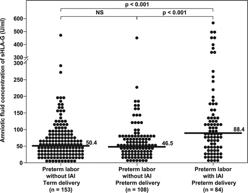 Figure 3.  Amniotic fluid concentration of sHLA-G among patients with spontaneous preterm labor and intact membranes (PTL). Patients with spontaneous preterm labor with intact membranes with intra-amniotic infection/inflammation (IAI) had a significantly higher median amniotic fluid concentration of sHLA-G than those who delivered preterm without IAI (PTL with IAI: 88.4 U/ml, IQR 43.5–142.9 vs. PTL without IAI: 46.5 U/ml, IQR 26.9–73.9; p < 0.001) and those with spontaneous preterm labor with intact membranes who delivered at term (PTL with IAI: 88.4 U/ml, IQR 43.5–142.9 vs. PTL delivered at term: 50.4 U/ml, IQR 29.8–85.9; p < 0.001). There were no differences in the median amniotic fluid sHLA-G concentration between patients with spontaneous preterm labor without IAI who delivered preterm and those who delivered at term.