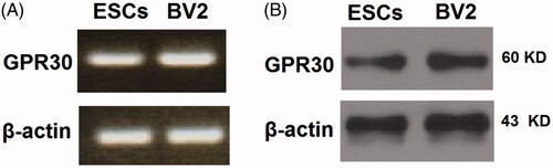 Figure 1. GPR30 is expressed in epidermal stem cells (ESCs). BV2 cells were used as a reference. (A) RT-PCR analysis of GPR30; (B) Western blot analysis of GPR30.