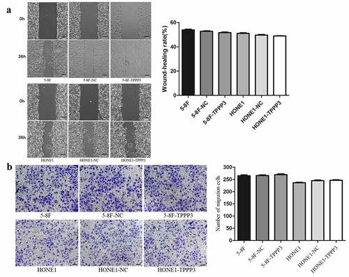 Figure 5. TPPP3 overexpression had no significant effect on the migration ability in NPC