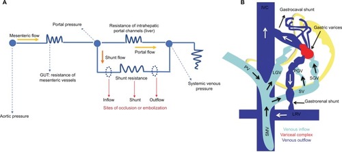 Figure 2 Circuit theory and hemodynamics of portosystemic shunts.