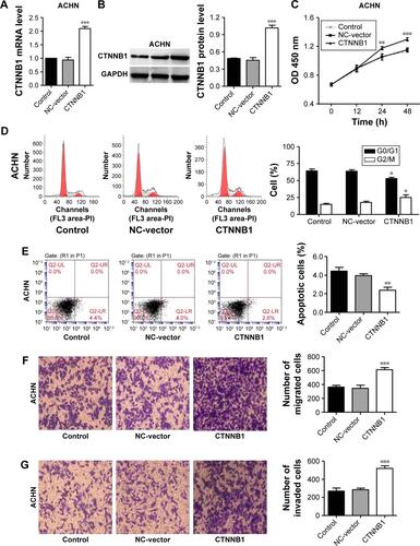 Figure S1 Effect of CTNNB1 on proliferation, apoptosis, migration, and invasion of ACHN cells. After treatment of ACHN cells (A and B) with pLKO.1-EGFP-CTNNB1 vector (CTNNB1), expression of CTNNB1 assay was analyzed by real-time PCR and Western blot, and cell proliferation (C), cell cycle (D), apoptosis (E), migration (F), and invasion (G) were performed as described in “Materials and methods.” Representative pictures of three independent studies are shown. Magnification, × 200. Data are presented as mean ± SD. *P<0.05, **P<0.01, ***P<0.001 compared with control groups.Abbreviations: PCR, polymerase chain reaction; SD, standard deviation; NC, negative control.