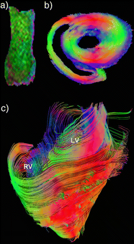 Figure 1. Diffusion images of the papillary muscles a) the short axis slice b) and the whole heart c). The green color indicates a main diffusion in up‐down, red in the left‐right and blue in the throughplane direction. (View this art in color at www.dekker.com.)