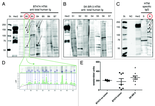 Figure 6. HTM generated antibodies that recognize a variety of antigens. BT474 and SK-BR-3 lysates were separated on a SDS-PAGE, transferred to a PVDF membrane and stained with serum of BT474 transplanted (B1–7) and SK-BR-3 transplanted HTM (S1–7), respectively. A polyclonal anti-HER2 antibody was used as a positive control (HER2). Non-humanized tumor mice (TM) served as negative controls (NC). The annotation “St.” refers to the lane of control proteins with standardized size. Tumor-specific antibodies were visualized by anti-Ig detection antibody (A and B) or anti-IgG detection antibody (C). BT474 HTM without detectable tumor are marked with red circles (B2, B3). Tumor cell line specific binding that did not appear on control cell lines are marked with arrows (A and C). (D) Quantification of bands was performed using the Image Quant software package. Each band contributes to the total value by individual thickness and intensity. (E) Western blot units are shown for SK-BR-3 and BT474 HTM divided into animals with or without tumor outgrowth.